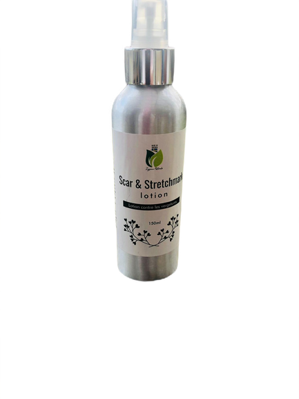 Stretch mark lotion