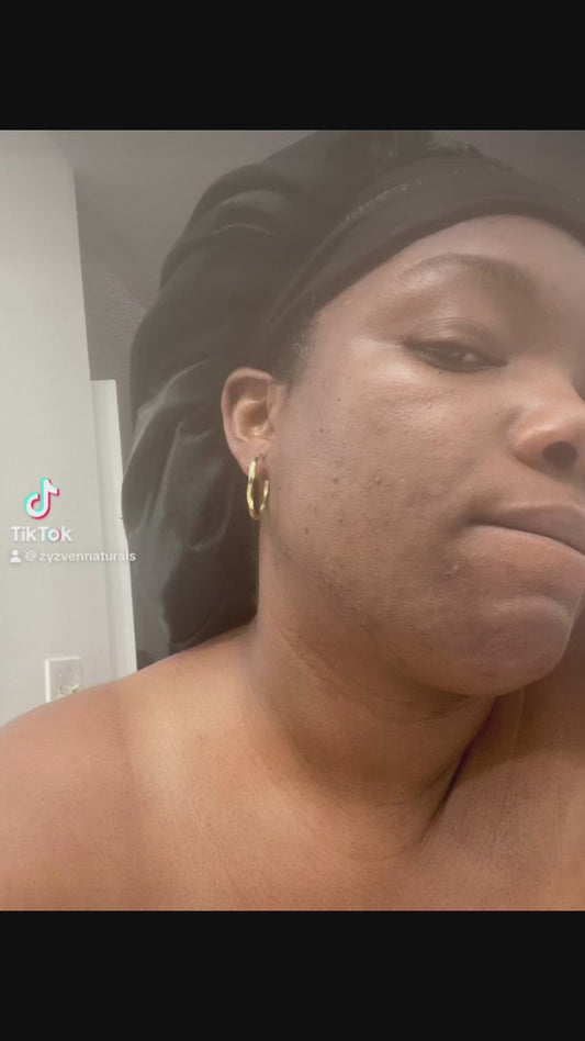 NAFI Acne & Hyperpigmentation Combo